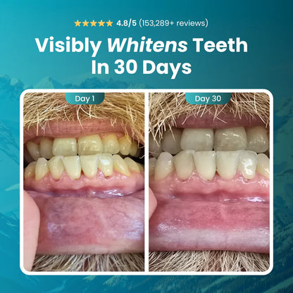 RevineCo - Remineralising Gum